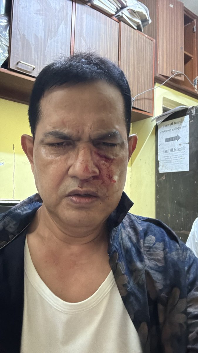MahuaMoitra's tweet photo. What’s going on in Bengal? Humayun Kabir IPS ex MLA, ex Minister brutally attacked by BJP goons at gate of Purba Jadavpur PS with 50 policemen watching. He is currently hostage inside PS, bleeding while goons trying to break open gates of PS. https://t.co/0801S0NNrF