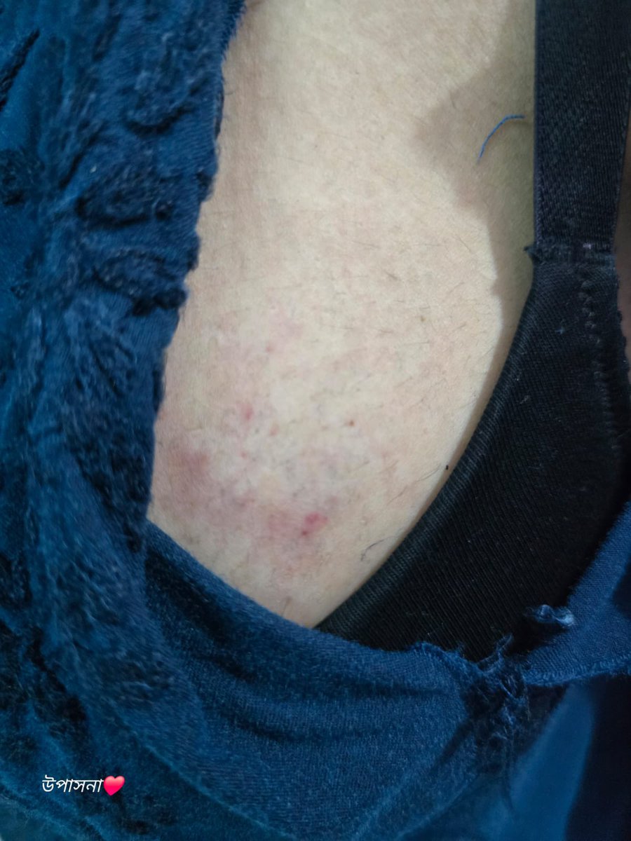 sagarikaghose's tweet photo. Brutal attack on @03upasana and others today. This only exposes the true face of the illegitimate @BJP4India regime in Bengal. Having seized power by “managing”  the SIR process, the @BJP4India regime is ruling through fear, intimidation and violence. Not one promise to the people fulfilled—only relentless atrocities, as the police watch mutely or actively participate. Law and order has not merely collapsed, law enforcers have become accomplices.