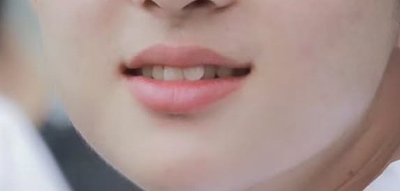 hsh_195's tweet photo. 하현승 앞니 교정했네라는 인용 보고 앞니?? 하면서 확대해봤는데 앞니 뭐임 이렇게까지 캐릭터성 있다고 https://t.co/N5DBHLOVll