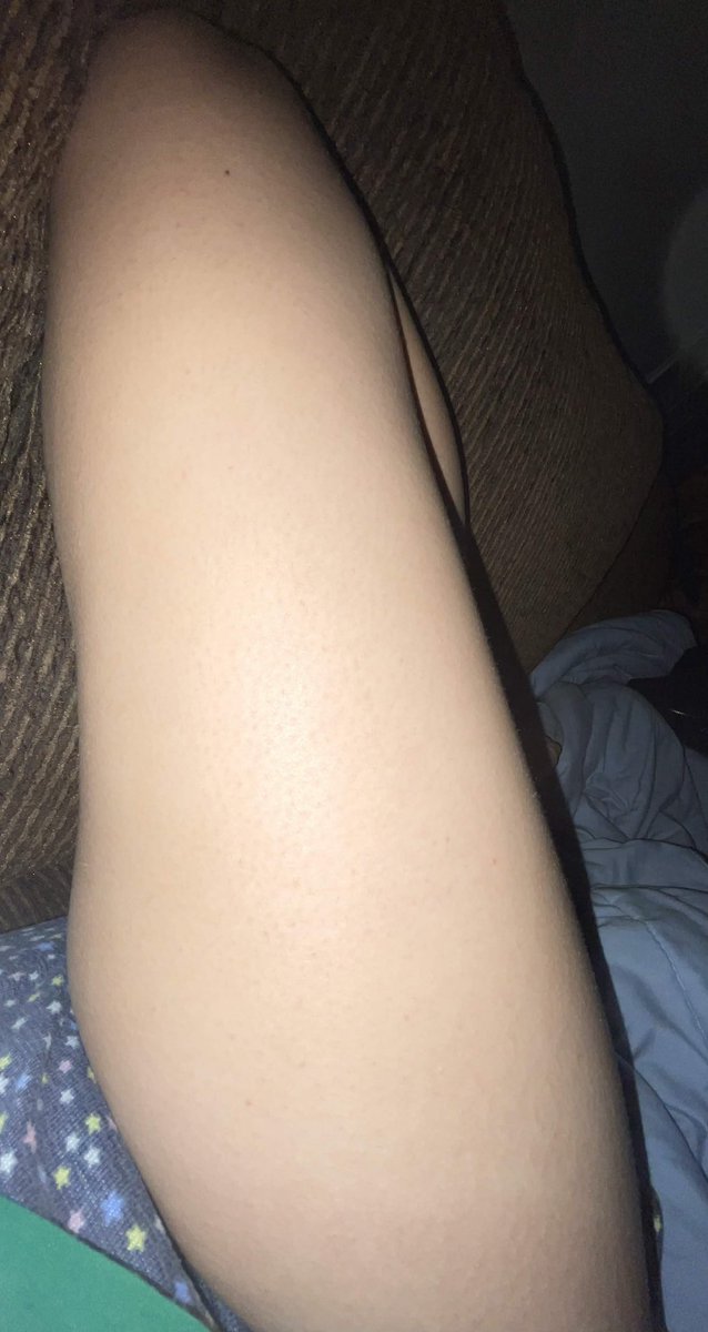 lynandbones's tweet photo. mourning how kinda thin i was
i was really just average at my lowest lololol https://t.co/7oAj16aSpt