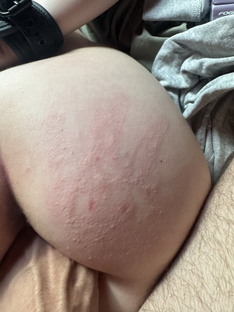 me0wzila's tweet photo. 🤕🤕
#nsfw #nsfwtwt #handprint #handcuffs https://t.co/TbGpGoIatK