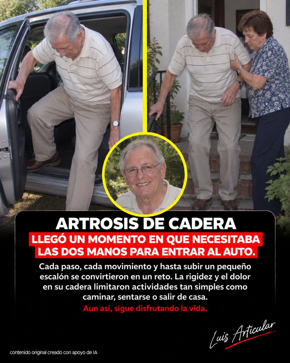 luisarticular's tweet photo. 🚗 Entrar al auto cambió todo
ㅤ
Roberto tenía 72 años y todavía conducía prácticamente todos los días.
ㅤ
Hasta que su cadera derecha comenzó a doler.
ㅤ
Primero fue una molestia al caminar. Después apareció rigidez al levantarse del sillón. Poco a poco empezó a utilizar los brazos para impulsarse.
ㅤ
Pero hubo un momento que hizo evidente cuánto había avanzado el problema.
ㅤ
Ya no podía entrar normalmente al automóvil.
ㅤ
Tenía que agarrarse del marco con una mano, apoyarse con la otra, sentarse de lado y después mover lentamente la pierna hacia el interior.
ㅤ
Algunos días su esposa tenía que ayudarlo.
ㅤ
🩻 Finalmente las radiografías mostraron artrosis avanzada de cadera.
ㅤ
Roberto comprendió entonces que aquellas pequeñas adaptaciones que había ido haciendo no eran simplemente consecuencia inevitable de cumplir años.
ㅤ
Comenzó un trabajo progresivo de fortalecimiento y movilidad.
ㅤ
Nada espectacular.
ㅤ
Levantarse y sentarse de una silla.
ㅤ
Fortalecer piernas y glúteos.
ㅤ
Caminar distancias tolerables.
ㅤ
Practicar movimientos necesarios para su vida cotidiana.
ㅤ
💪 Poco a poco empezó a sentirse más seguro.
ㅤ
La artrosis seguía allí, pero algunas de las actividades que había ido abandonando comenzaron a resultar nuevamente posibles.
ㅤ
Ese es un punto importante: mejorar una artrosis no siempre significa hacer desaparecer el daño de la articulación.
ㅤ
También puede significar recuperar fuerza suficiente para desenvolverte mejor con la articulación que tienes.
ㅤ
Para Roberto, una de sus medidas de progreso terminó siendo sorprendentemente sencilla.
ㅤ
Entrar al automóvil.
ㅤ
Aquello que durante décadas hizo sin pensarlo había llegado a requerir las dos manos y la ayuda de su esposa.
ㅤ
Recuperar parte de esa capacidad significaba algo mucho mayor que conducir.
ㅤ
Significaba independencia.
ㅤ
Porque muchas veces no descubrimos cuánto vale nuestra movilidad hasta que acciones tan pequeñas como levantarnos, caminar o salir de casa dejan de ser automáticas.
ㅤ
Si quieres conocer más historias y estrategias para conservar movilidad frente a la artrosis, visita el enlace de mi perfil.
ㅤ
#MovilidadEnLaVejez