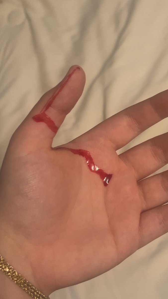 fallen4starr's tweet photo. I accidentally stabbed myself while cleaning https://t.co/xscJuhXNPv