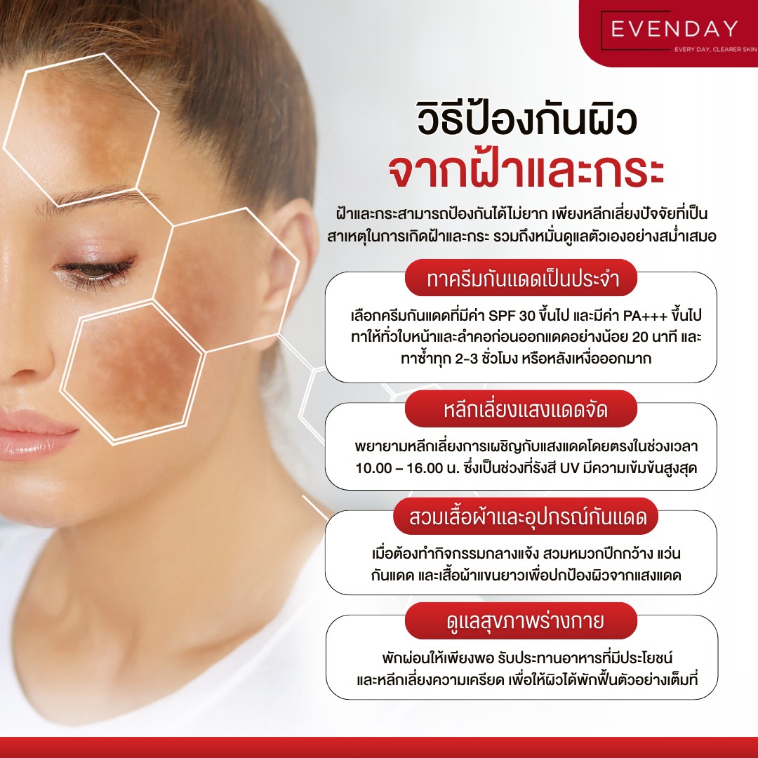 NydiaRohrbmec's tweet photo. How to protect your skin from melasma and freckles

Start caring for your skin today for a clear, beautiful complexion. Apply SPF 30+ sunscreen daily, 20 minutes before sun exposure, and reapply every 2–3 hours. Avoid strong sunlight from 10 a. m. https://t.co/bECFhciDWK