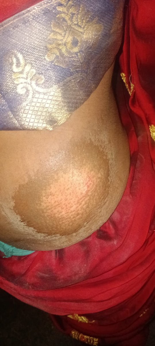 NewsL12045's tweet photo. कौशांबी थाना के कारखास सिपाही चोखेलाल पर लगे गंभीर आरोप सिपाही की मिलीभगत से हो रहा है नाबालिक बच्चियों का खरीद फरोख्त सिपाही के ऊपर लगे मारपीट करने और 60 हजार रूपये लेने का आरोप लगाया पीड़ित
@dgpup @Uppolice @kaushambipolice https://t.co/m4hStK5m1g