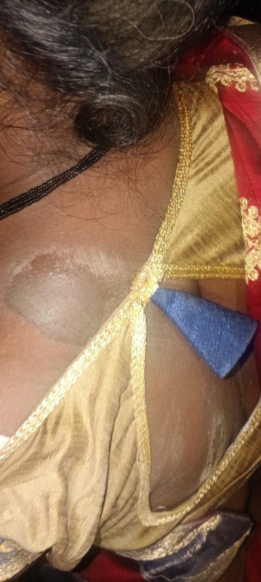 NewsL12045's tweet photo. कौशांबी थाना के कारखास सिपाही चोखेलाल पर लगे गंभीर आरोप सिपाही की मिलीभगत से हो रहा है नाबालिक बच्चियों का खरीद फरोख्त सिपाही के ऊपर लगे मारपीट करने और 60 हजार रूपये लेने का आरोप लगाया पीड़ित
@dgpup @Uppolice @kaushambipolice https://t.co/m4hStK5m1g