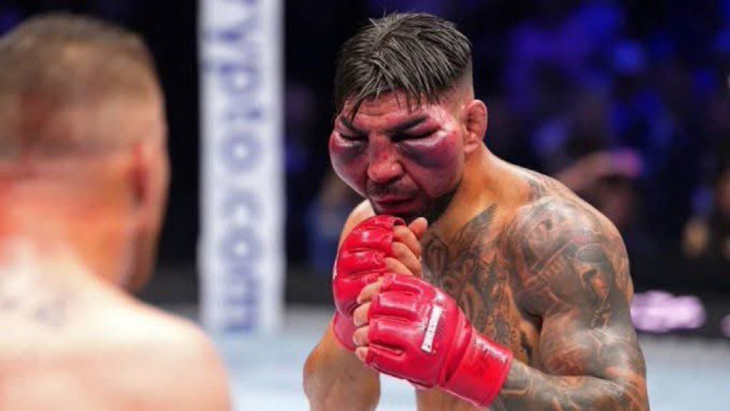 notlightl's tweet photo. @DovySimuMMA This idiot goblin, his friend surrendered and he wants him to get another undeserved shot at the title 🤡🤡 When will this ugly guy stop hyping up Topuria https://t.co/RrqE2AdDUH
