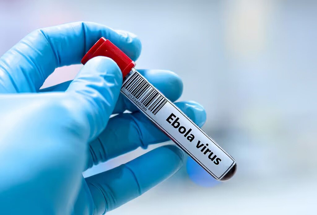 Emp_Avilmat's tweet photo. En marcha ensayo de vacuna contra el ébola😷💉

La Organización Mundial de la Salud (@opsoms ) anunció que un programa investigativo de inmunización con la vacuna Ervebo, única autorizada contra el ébola, está en marcha hoy en Ituri, El Congo 🇨🇬

#CubaSalvaVidas #LatirAvileño https://t.co/2bpoa8pm9L
