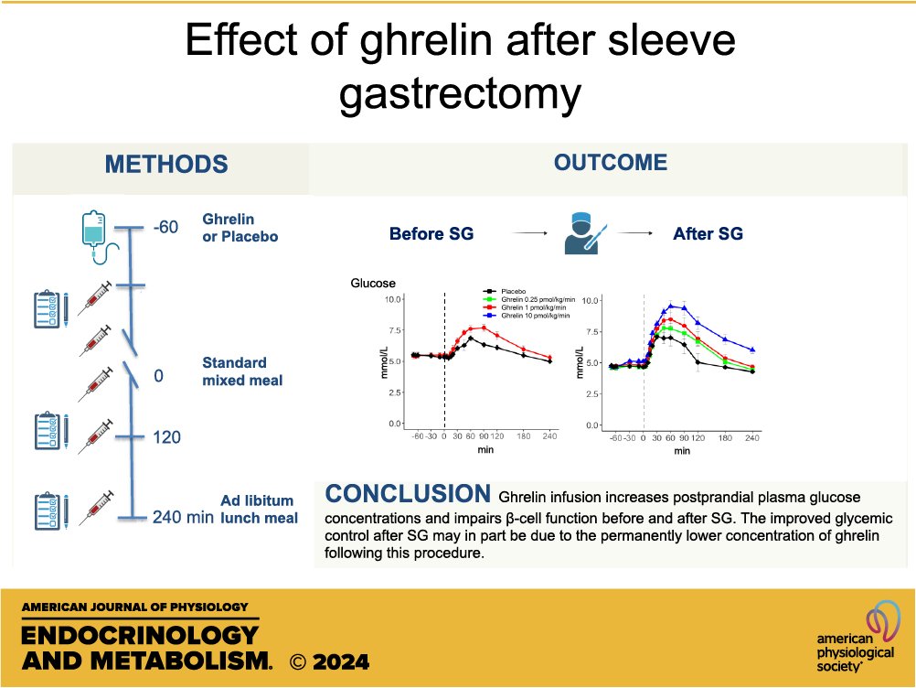 AJPEndoMetab's tweet photo. An equally large and talented team from @UCPH_Research put together today's paper in our Clinical Metabolism collection, Effect of ghrelin on #glucose tolerance, gut #hormones, #appetite, and food intake after sleeve #gastrectomy (Nora Hedbäck et al.):

https://t.co/RtxKv6FZxQ https://t.co/Ea0AEkvBsm