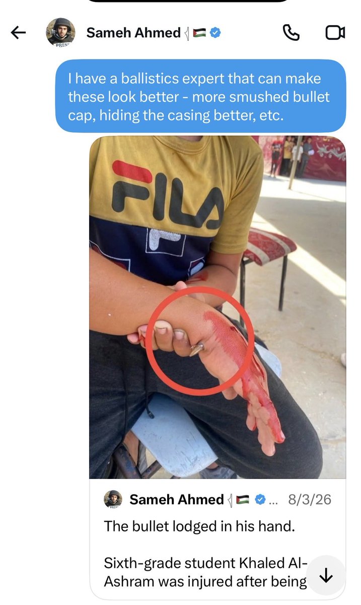 BriannaWu's tweet photo. A famous Palestinian “journalist” agreed to work with the Hollywood Makeup artist to fake Israeli atrocities better. 

And was willing to use children with cerebral palsy to fake starvation. 

But bailed when he found out the Makeup artist was non-binary. https://t.co/DPFv5McVgX
