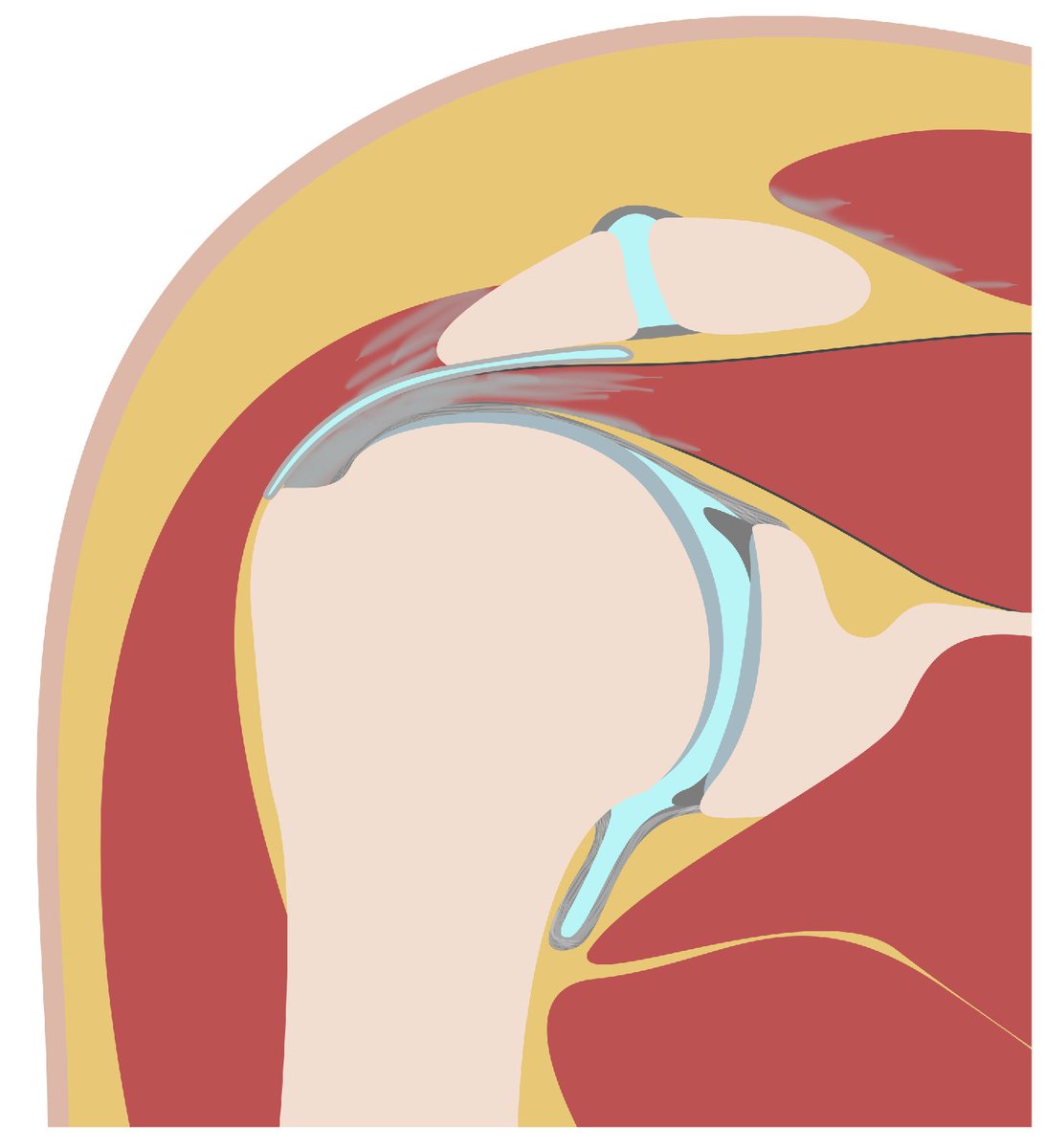 docskalski's tweet photo. I asked gemini "Make this illustration I made of a coronal cross section of the shoulder look like a high quality 3d render." It's not perfect, but nothing a little time in photoshop can't fix (or given a little more instruction to the AI) https://t.co/bt8yXhB6Pm