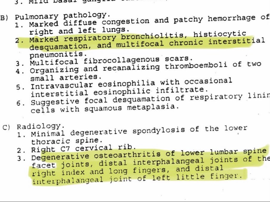 myapriest's tweet photo. lupus isn’t BOLDY listed on an autopsy, that’s very common. but the autopsy shows the structural damage and issues of his type of lupus. 2. michael also took plaquenil, which a type of medication for LUPUS.. he didn’t take that shit for fun. 3. he was diagnosed in early 1980s. https://t.co/jFF5naUY7D