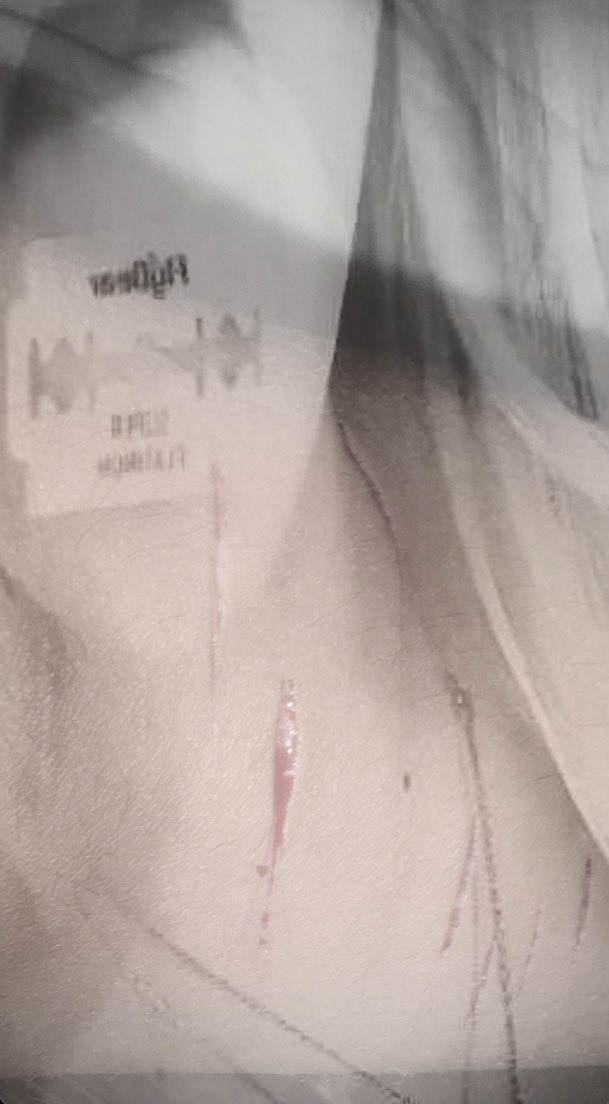 ewavanii's tweet photo. SFX MAKEUP FOR MY NEW ART PROJECT, tiny sesh i was lazy asf #sfx #fakeblood #shtwt https://t.co/13HeyBRVyM