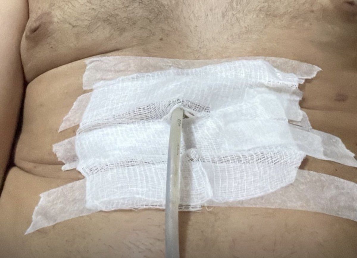 MarcoValverde72's tweet photo. @ciroprinces Com as despesas da água de R$67, da internet de R$135 e os R$180 do carro para ir à consulta dia 25/09, quando espero tirar a sonda, ainda preciso de ajuda. 🥹🙏 Qualquer valor dado com AMOR 🧡

PIX: 018.959.489-67 https://t.co/2v348czU4B