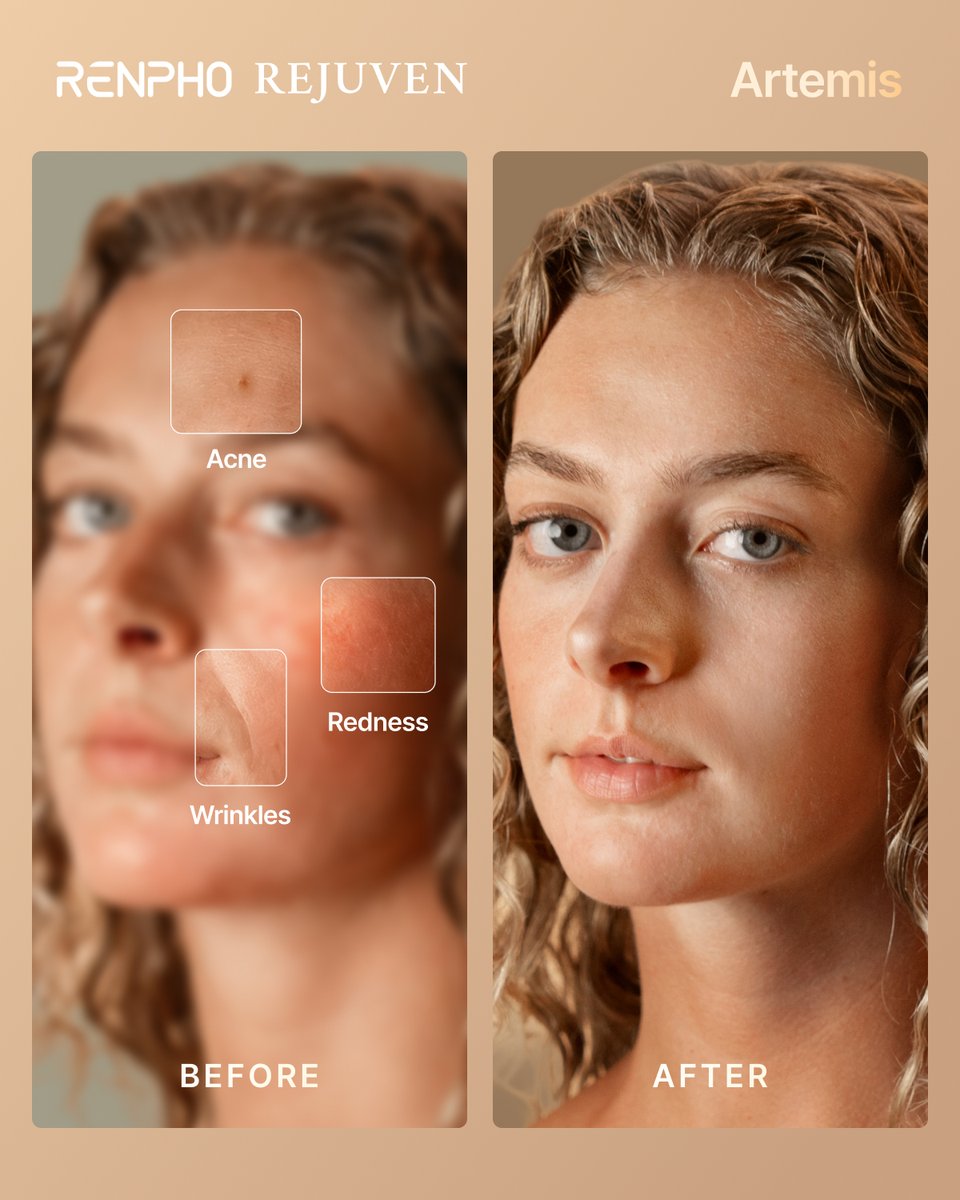 renpho's tweet photo. Everything you need to know about the RENPHO Rejuven Artemis LED Mask, all in one place. ✨

Swipe through to see how it works, what makes it stand out, and how to make it part of your self-care routine!

Learn more at https://t.co/yWWi8DN6sv

#RENPHO #Wellness #SelfCare https://t.co/EEST7lh9tO