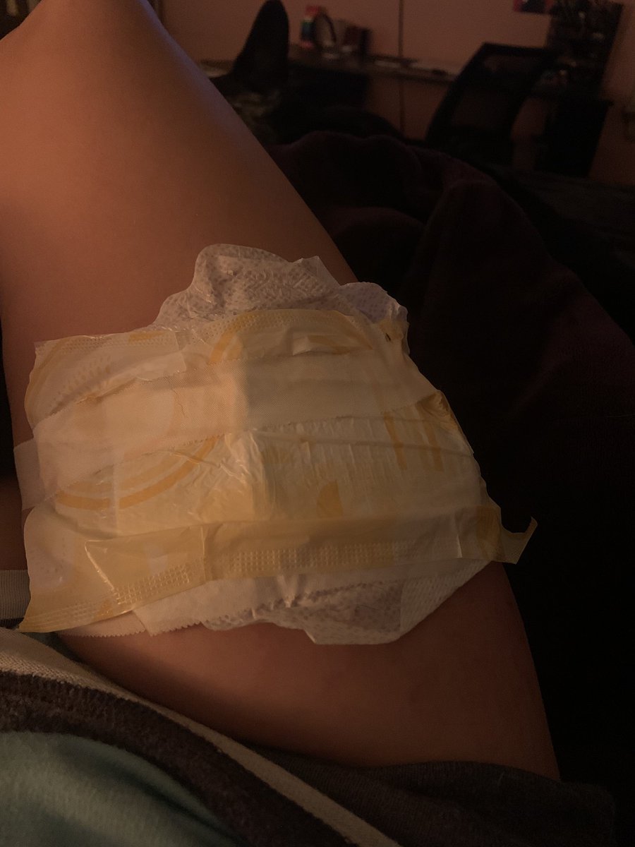 shellytheshell9's tweet photo. Dude my mom just used a pad to heal my #Scars 😭😭😭 https://t.co/9XL53LYD1K