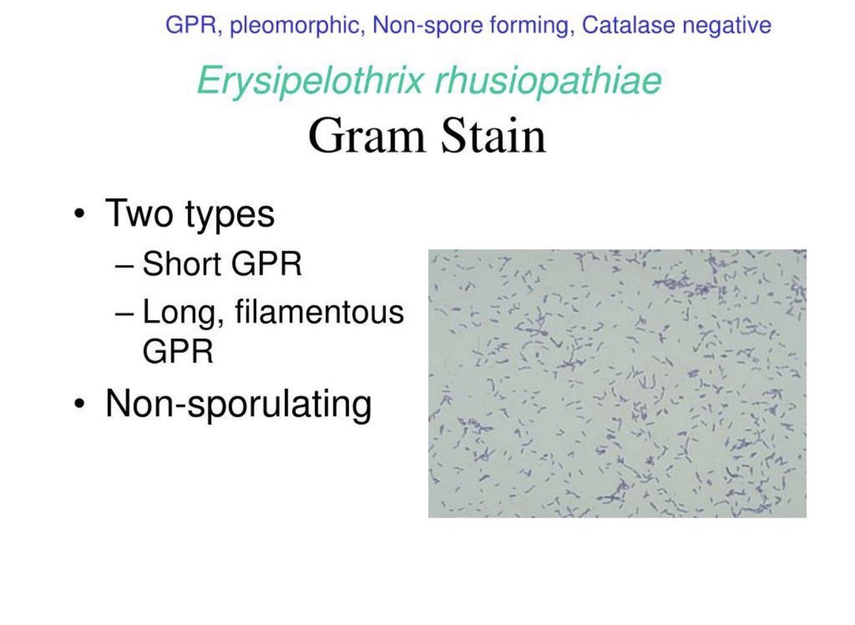 laboratorykh's tweet photo. Erysipelothrix rhusiopathiae

📌 من المعلومات المهمة في اختبار الهيئة SLLE

🥩 Erysipelothrix rhusiopathiae تُعرف بـ “بكتيريا الجزار”
لأنها ترتبط بالعدوى المهنية لدى الجزارين والعاملين مع الحيوانات والأسماك والأطباء البيطريين

🔬 ما هي؟
بكتيريا Gram-positive rod، غير مكوِّنة للأبواغ، وتتميز بأنها Non-motile & Catalase negative

🦠 أهم الأنواع سريريًا:
E. rhusiopathiae

🐷 في الحيوانات:
تسبب Erysipelas، خصوصًا في الخنازير.

👨‍⚕️ في الإنسان:
تسبب Erysipeloid، وهي عدوى جلدية موضعية تحدث غالبًا بعد دخول البكتيريا عبر جرح أو خدش بالجلد أثناء التعامل مع الحيوانات أو الأسماك واللحوم المصابة

⭐ احفظها للاختبار:

Butcher + Animal/Fish exposure + Skin lesion → Erysipelothrix rhusiopathiae

Gram-positive rod + Non-motile + Catalase negative 🧫

#مختبرات_طبيه
#microbiology
 #bacteria