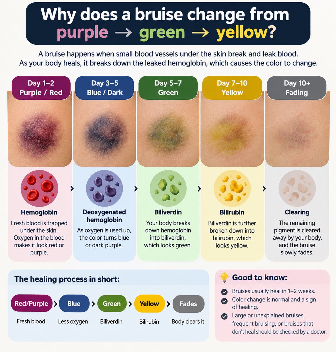 glowwellness085's tweet photo. Ever wondered why a bruise turns purple → green → yellow? 

It’s actually your body cleaning up after an injury! https://t.co/1SZU6cQPv5