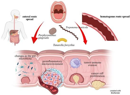 DrGrahamLJ's tweet photo. Challenge to all doctors:
Look up gum disease bacteria.
You will you learn about cancers of the gut.

NOTE: Gum disease bacteria get to the gut via two routes - 1) swallowing and 2) leaking into the bloodstream via damaged gums

Rebersak and Schara 2025
https://t.co/RNNoohCM6v https://t.co/CR0VN2r1Jc