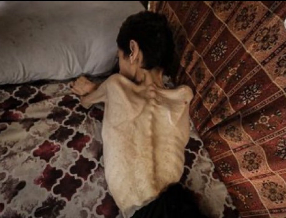 ros_sara2002's tweet photo. Starvation in Gaza

Not Germany 1943, Gaza 2026 https://t.co/VrQd6zOPNL