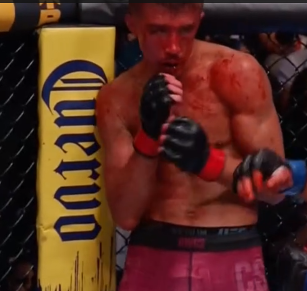 Pep_Lima's tweet photo. I'm not even trying to be funny, this kid just threw away 10 years of life in 15 minutes.

Absolute brutal. 
#DWCS https://t.co/gGyi78Hlrv