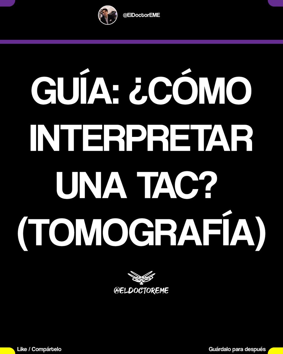 eldoctoreme's tweet photo. 🤓GUÍA RÁPIDA: TOMOGRAFÍA (TAC)🤓
📌Hilo con📌

•Técnica y Generalidades
•Cráneo
•Tórax
•Abdomen y Pelvis
•Resumen/Interpretación General/Indicaciones

Encuentra más información en https://t.co/NPENohmrHa

#ENARM #MIR #USMLE #ENARM2026 https://t.co/2U7ogbohls