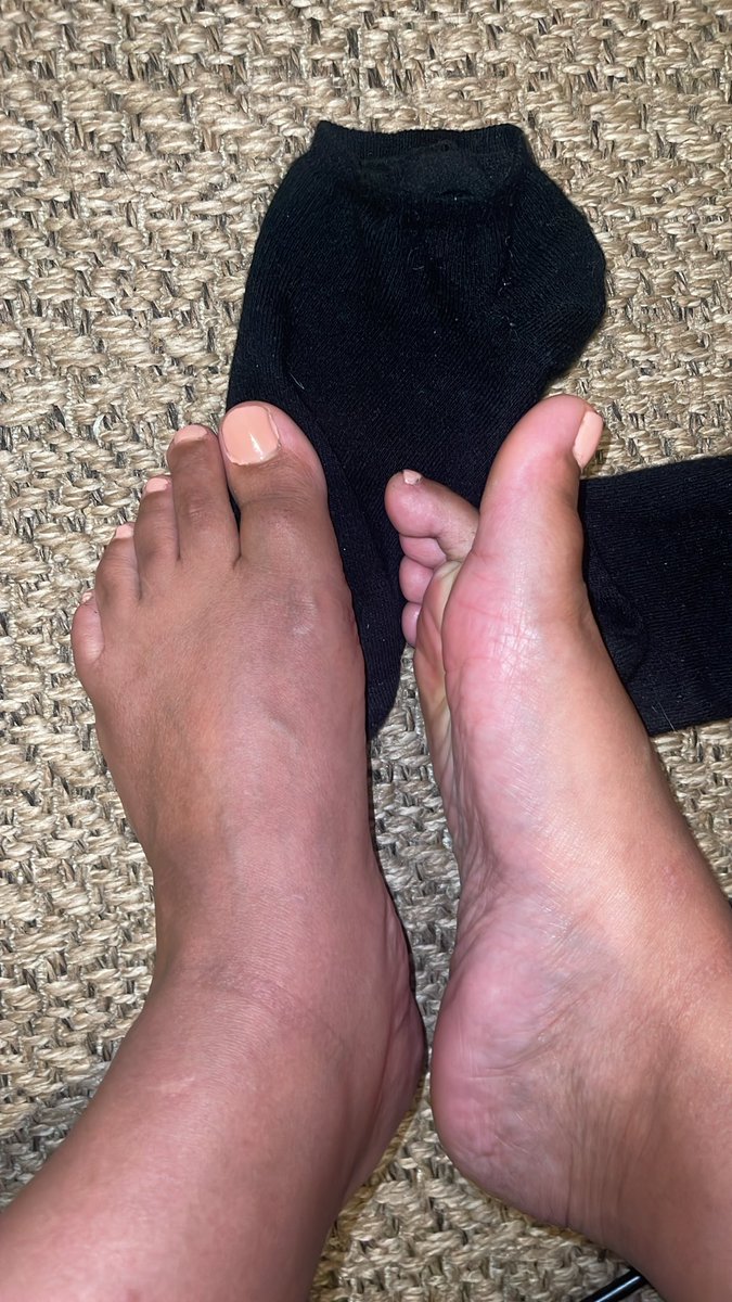 ShylarsFeetx's tweet photo. Loser ! Who’s going to be my first customer 😍 https://t.co/L8Mq5lVQJ2