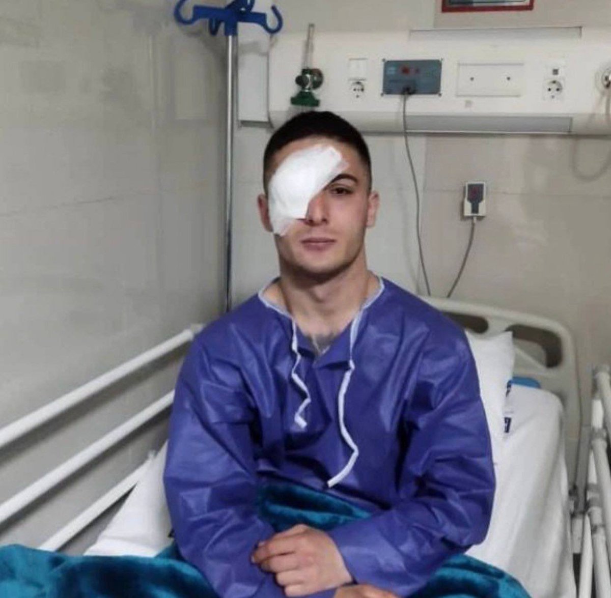 MasMas2171's tweet photo. 🆘🚨 SOS. URGENT. A LIFE IS ABOUT TO BE TAKEN. 🚨🆘

ALI ZAREI IS ABOUT TO BE EXECUTED IN IRAN.

The Islamic Republic already SHOT OUT HIS EYE during the Woman, Life, Freedom uprising. They stole half his sight. Now they want the rest of his life.

He is 27. A protester. A survivor. They transferred him to SOLITARY CONFINEMENT at Ghezel Hesar Prison. That is how they prepare people for the noose.

WHILE WORLD LEADERS SIT IN NEW YORK AND GIVE A PLATFORM TO THE MURDERERS.

Right now, at the UN General Assembly, the president and foreign minister of this terrorist regime walk the halls, shake hands, give speeches, and whitewash a massacre. They are treated like statesmen while their hangmen tighten the rope on Iranian protesters at home.

THIS IS THE HYPOCRISY.
They lecture the world about “justice” in Manhattan.
In Karaj they prepare to hang a young man whose only crime was demanding FREEDOM.
They blinded him.
They hunted him.
They sentenced him to death for “corruption on earth.”
Now they want to finish the job.

@POTUS
@UN
@antonioguterres
@UNHumanRights

Amnesty. Human Rights Watch. Every human rights organization that still claims to have a conscience:
DO NOT LET THEM KILL HIM WHILE YOU APPLAUD THEIR LEADERS.
Every hour you give this regime a microphone is another hour Ali Zarei moves closer to the gallows.

STOP THE EXECUTION OF ALI ZAREI.
STOP THE PLATFORM FOR HIS KILLERS.

THE WORLD IS WATCHING. ACT NOW.