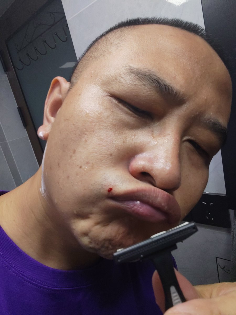 JamesCageWhite's tweet photo. I'm shaving beard,and I'm bleeding 😭 fate https://t.co/5J8moIeqVY