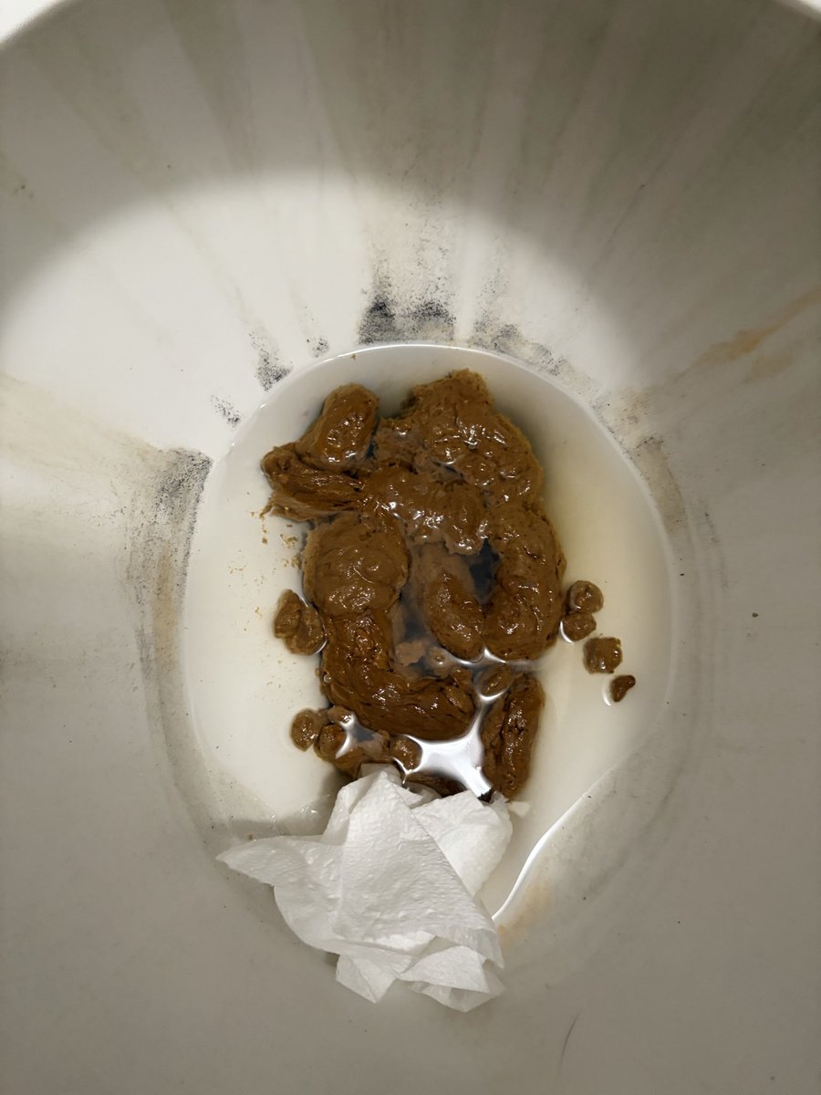 Jc18876159's tweet photo. Took a big poo today. people in my house said it stinks bad i was surprised as well it was stinky. so nice of them to compliment me like that 💩 😈. #gayscat #scat #pooping #shitfetish #shitpig #gayfetish #shitpig #pooping #gaypoop #gayshit #malescat #poop #coprophilia https://t.co/78D3aifxBY