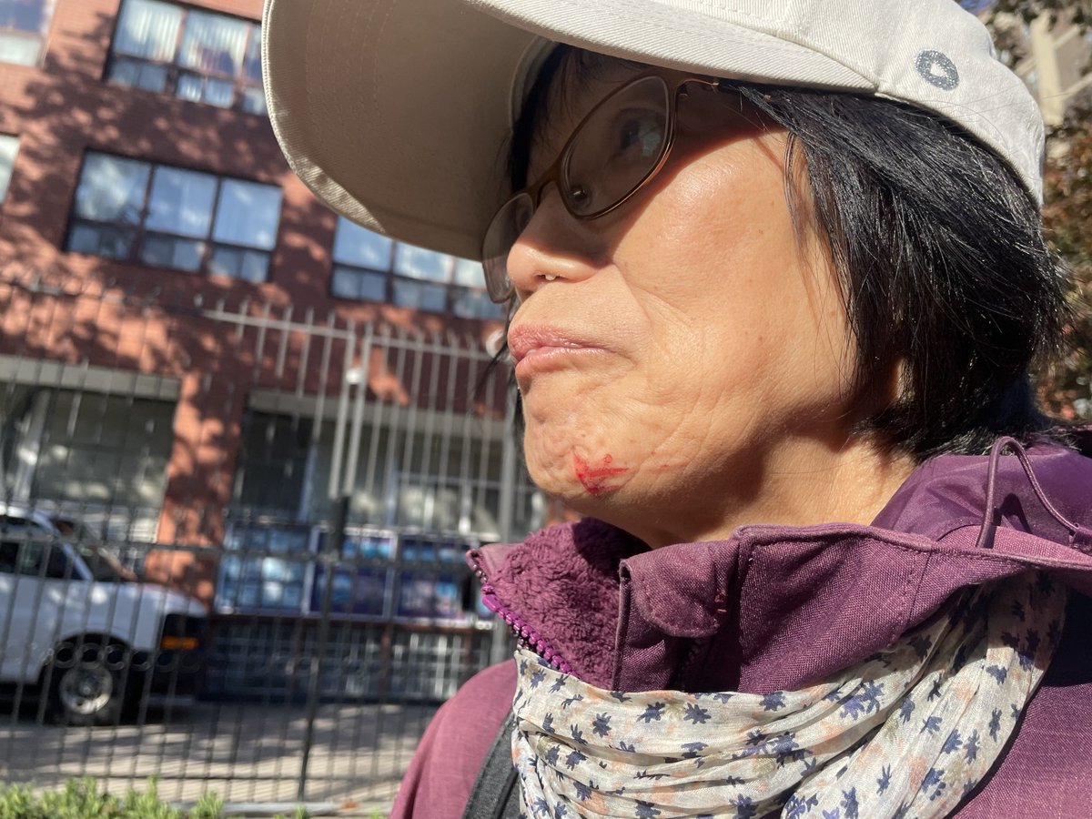 WhatisonToronto's tweet photo. @TorontoPolice @TheTorontoSun @TorontoStar @globeandmail It happened today Sep 22, 2026. The lady got hurt in the chin. https://t.co/cyVLUbnC18