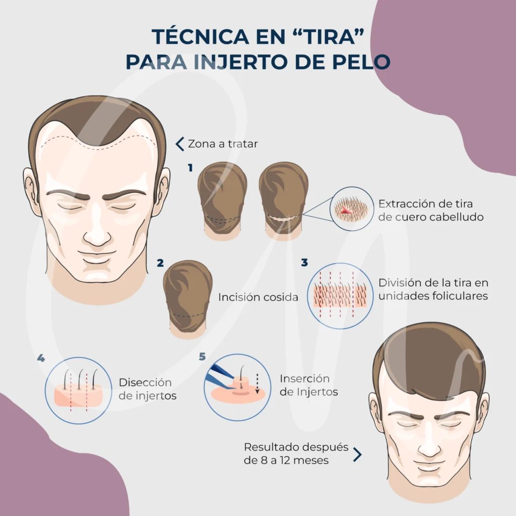 Blinkywinky71's tweet photo. @Puflito___ Ustedes también se indignan de sacarse pedazos de piel cuando les conviene eh https://t.co/PdWXkGqCTr