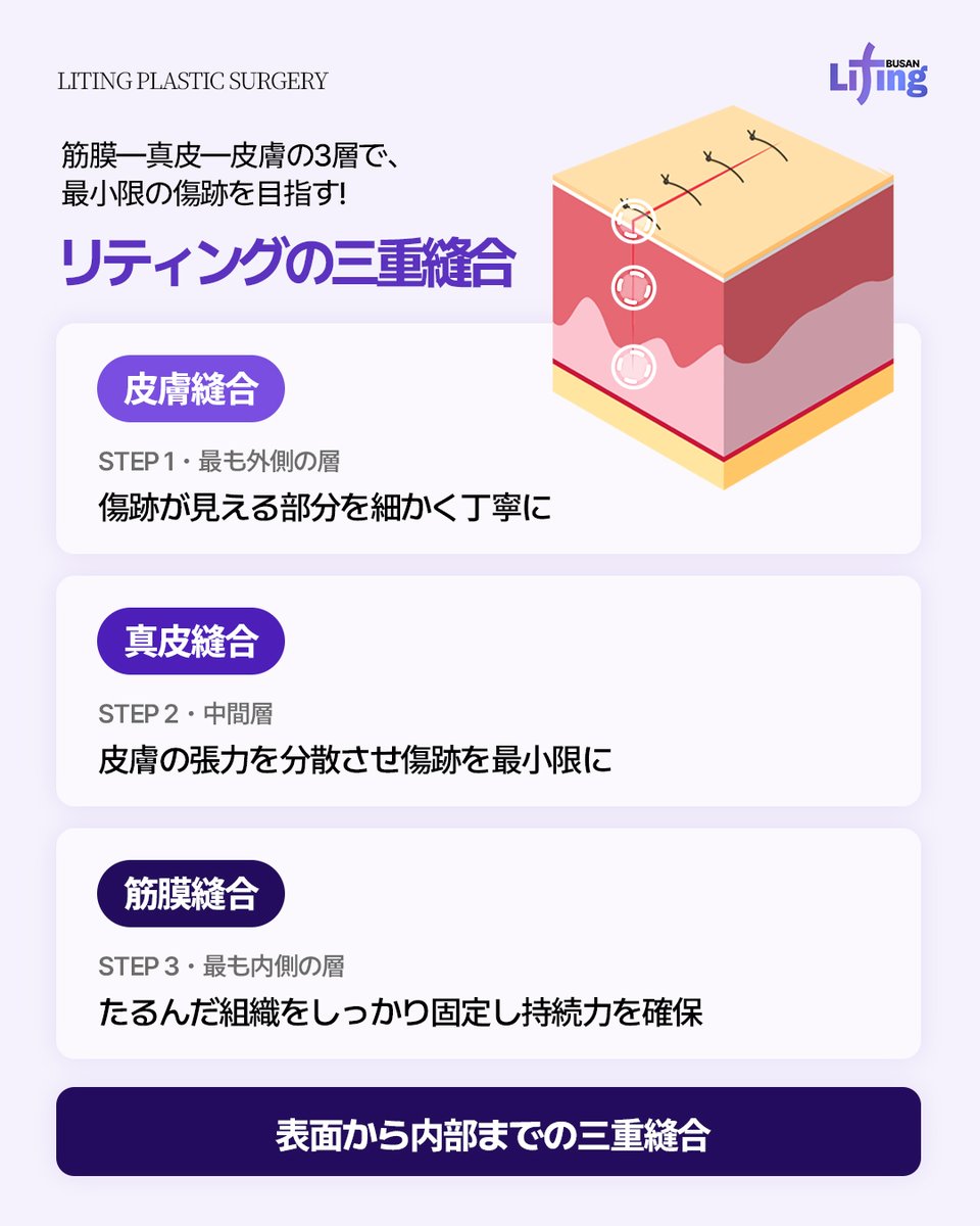 liting_japan's tweet photo. リティング釜山[三重縫合]💜

リフティングの三重縫合で、
傷跡への負担を抑えながら、しっかり引き上げる。✨

皮膚・真皮・筋膜をそれぞれ丁寧に縫合し、
自然なリフトアップを目指します。🤍

ーーーーーーーーーーーーーーーーーーーーーー
🔅リティング釜山2026福岡相談会🔅
日程：10月18日(日)

★代表院長と１：１カウンセリング可能
★参加者全員にプレゼントあり！
★日本相談会限定特典サービス付き

お問い合わせはこちら♡
ID: @litingjp_busan / 🔗https://t.co/eVkxWduYTK

お気軽にご相談ください💨

#韓国整形 #カウンセリング ＃相談会