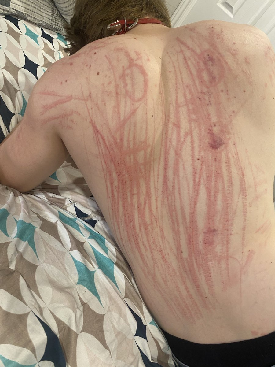 GodessDKamer's tweet photo. Depuis quelques temps, 
j’ai développé une OBSESSION pour les dos BIEN larges🤤. Ce sont de magnifiques toiles qui ne demandent qu’à accueillir mon art 🔪

Et toi, m’offriras-tu ton dos pour que j’en fasse ma prochaine toile ? 

PS: C’est la version soft ici https://t.co/sZJWyv8fiw