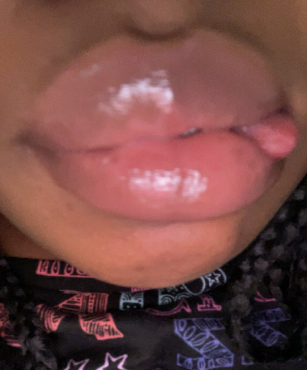 countessdragula's tweet photo. should i do lip content? #dsl #lips #lipfetish #paypig https://t.co/UjkXTPrQZI