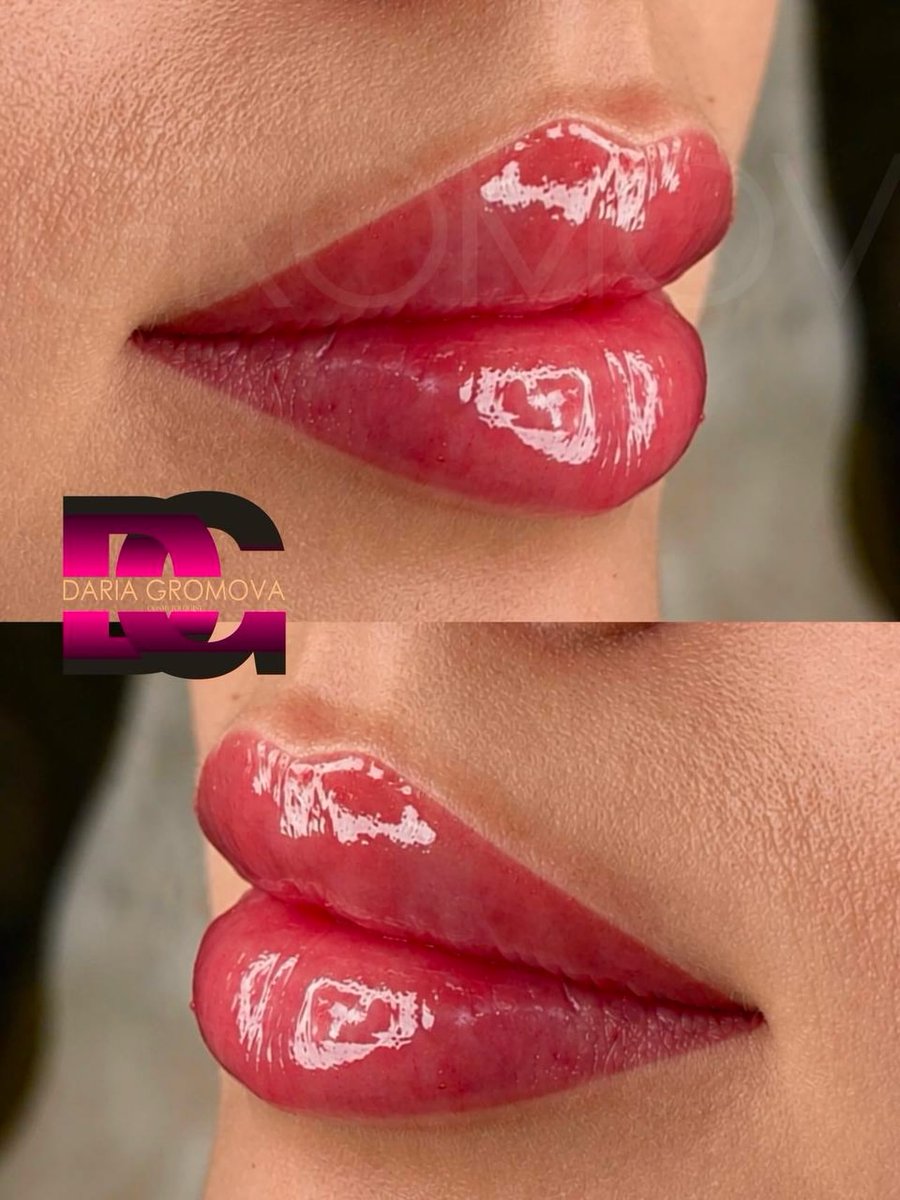 TequilaByan's tweet photo. Russian Lips is a precision technique designed to enhance lip shape with a beautifully defined cupid’s bow, improved symmetry, and elegant vertical height while maintaining a refined, sophisticated appearance. Every treatment is fully customized to https://t.co/LNwZnfHQct