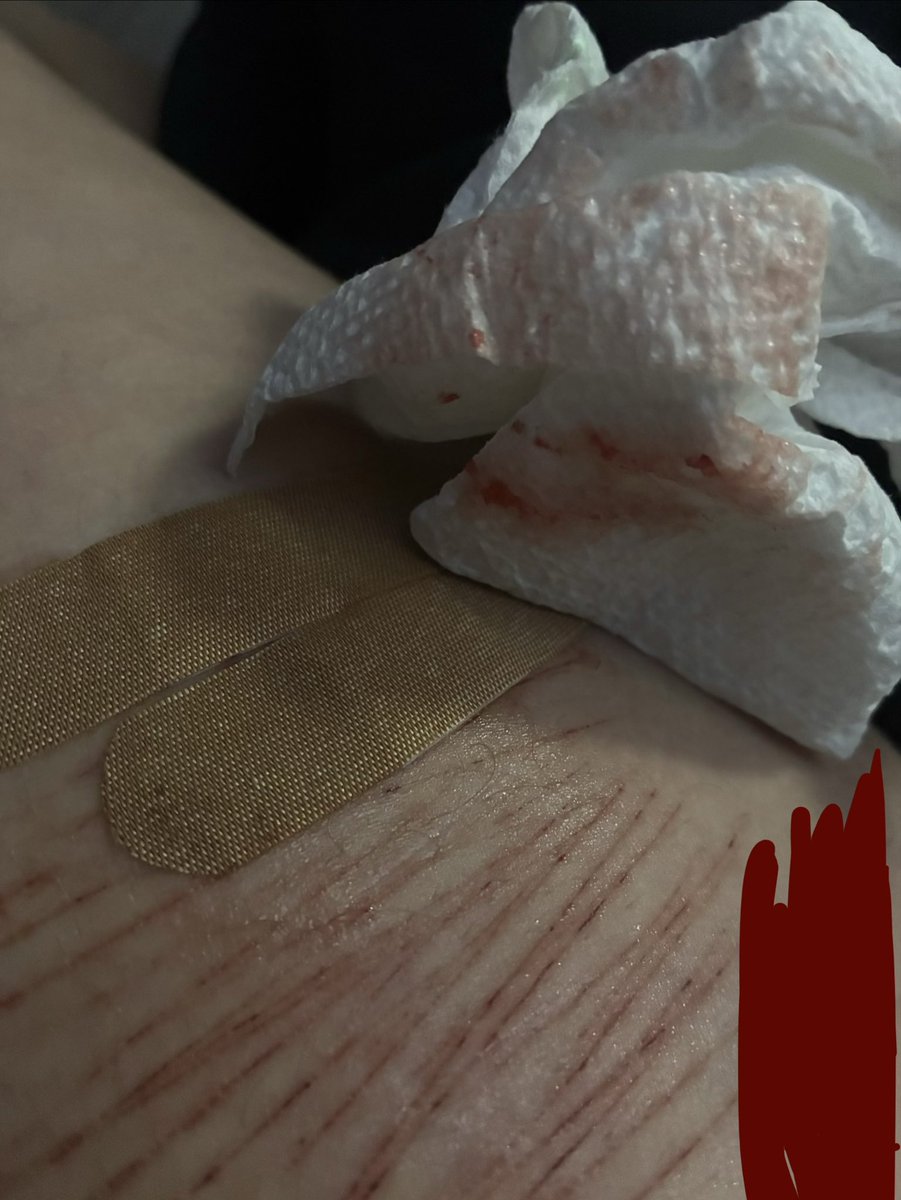 timpklt's tweet photo. new blade :3 and i did a baby deeper cut for the first time i ever went a lil deep ik its so small but it’s oki :3 TW⚠️ https://t.co/l7eGtFfAWn