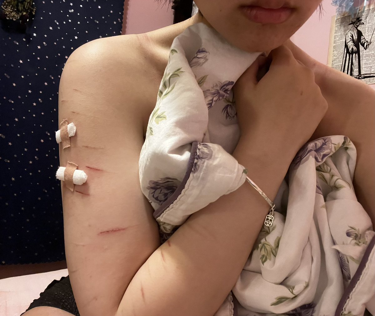 hypoderm1s's tweet photo. My mom walked in while i was taking this pic bruh and I don’t even look that good here I look fat asf https://t.co/0b5um6jVKi