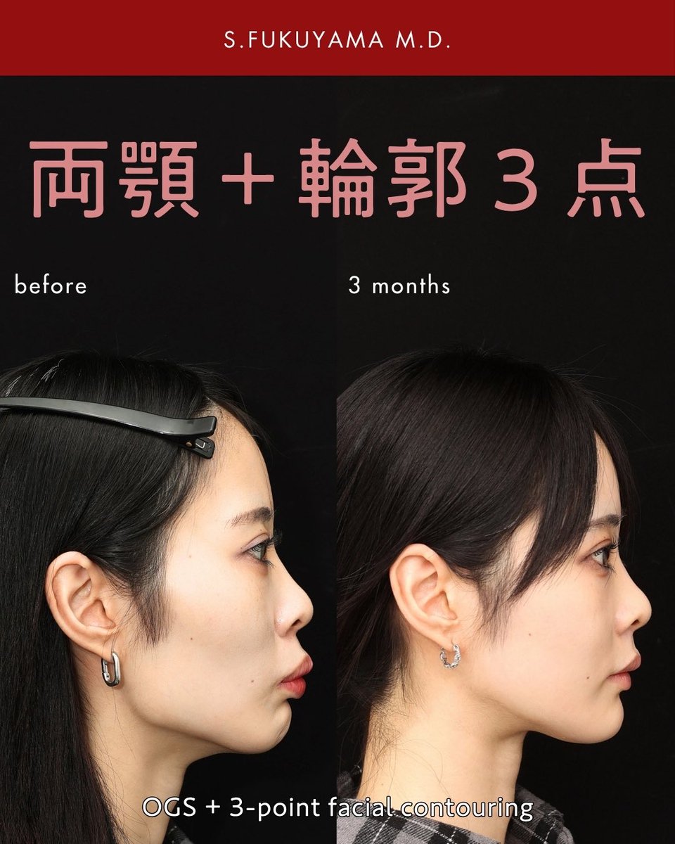 kotsukotsukiri's tweet photo. 正直、かなり変わりました。

「伸び代」を見抜き、適切な施術を勧めます。

本来の可能性を引き出して、勇気ある人々を応援します。

@dr_yamachan https://t.co/8m0HqZeaGh