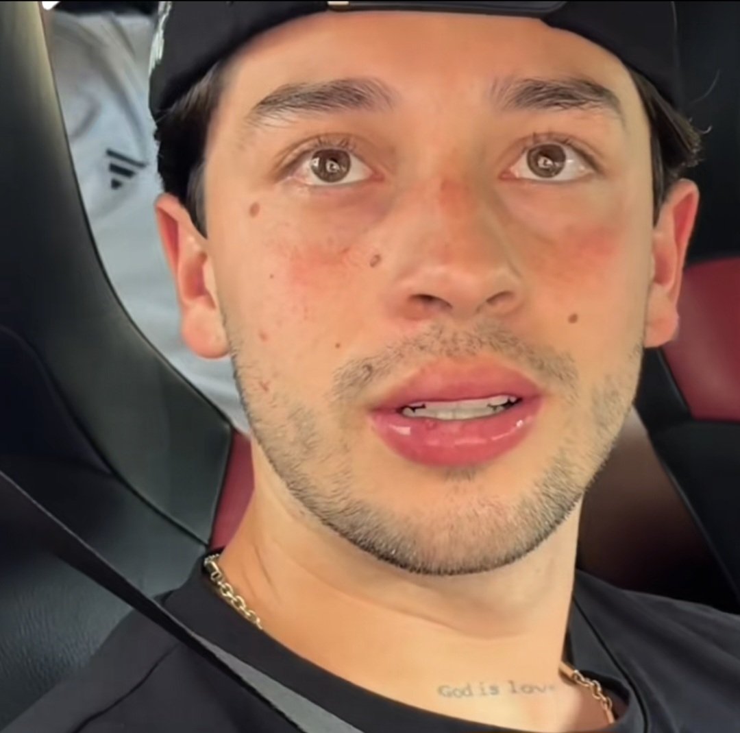 moonthekid's tweet photo. Como es posible que alguien tenga tan bonito color de labios y ese blush natural TAN precioso😭 https://t.co/I4vl1qs4UO