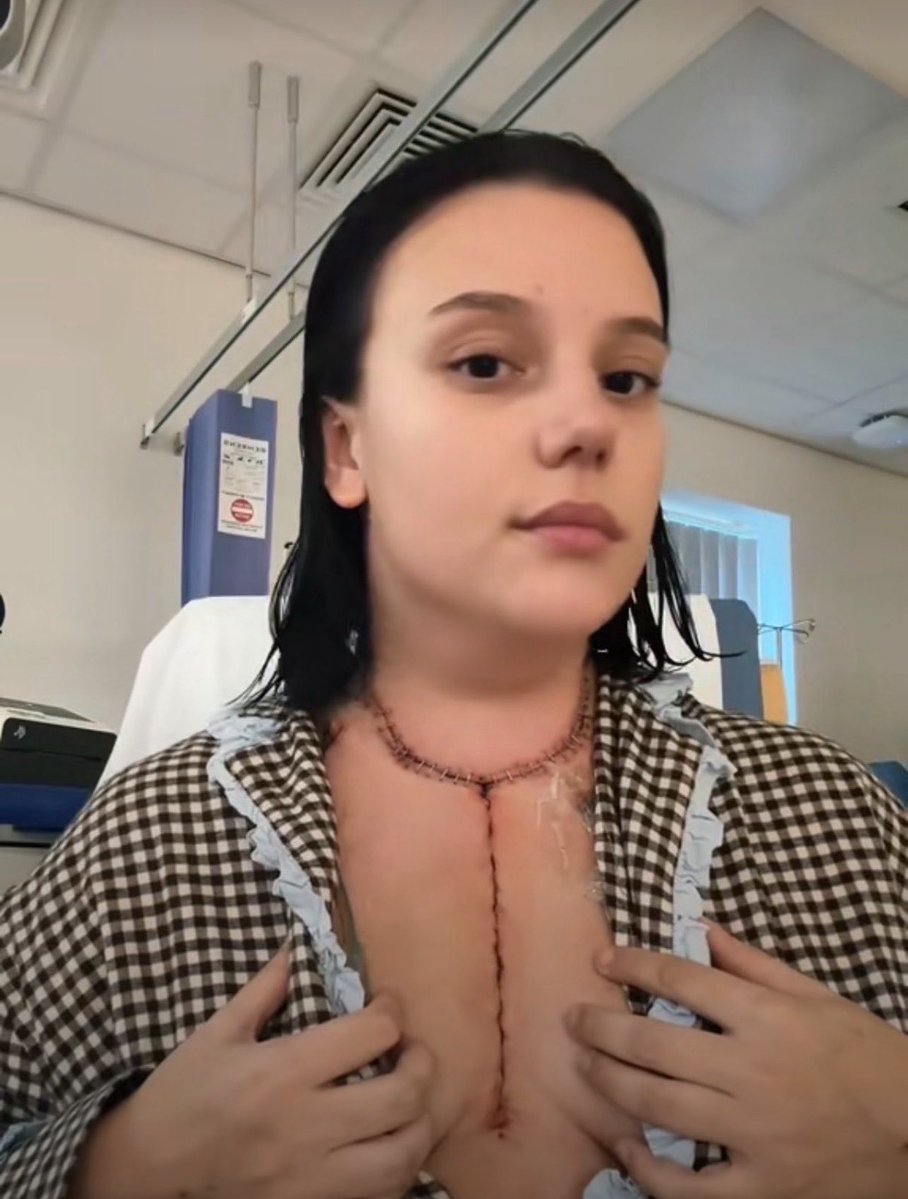 dukesurge's tweet photo. She beat lungs cancer 🎉🎉🎉🎉🥹🥹🥹❤️❤️❤️❤️

A moment worth celebrating forever 🥹❤️‍🩹 https://t.co/mGHnlnwcKD