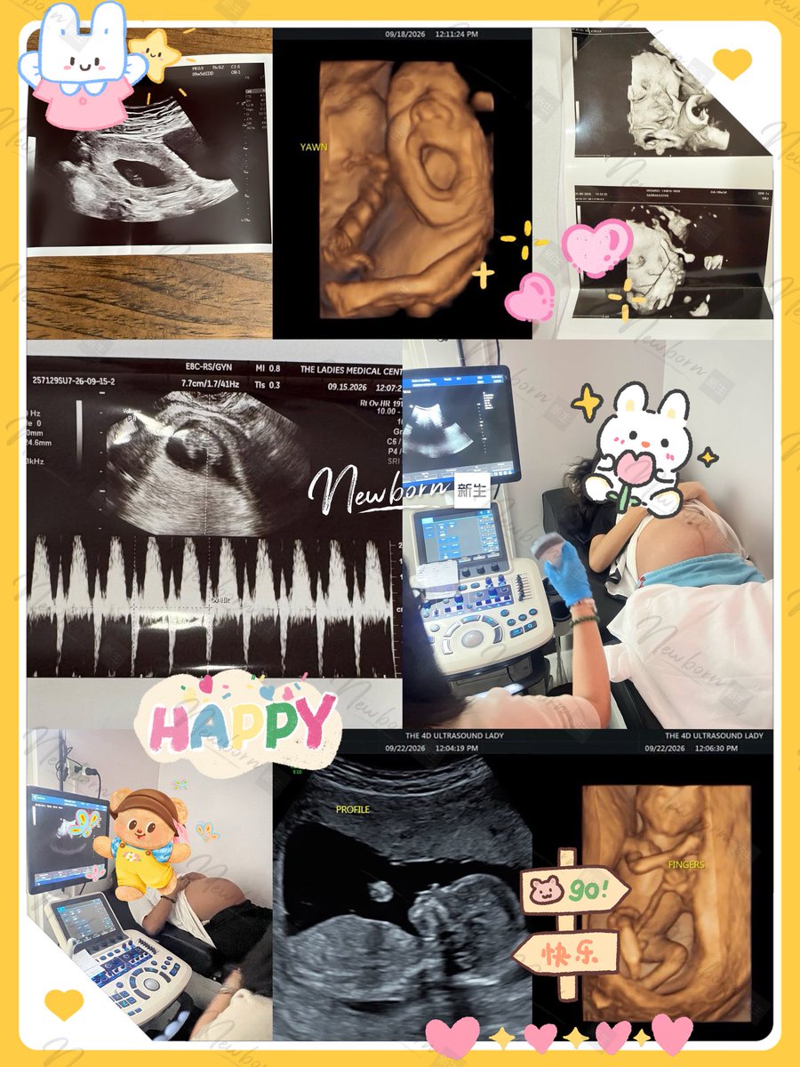 PengYu04309442's tweet photo. 秋分已至，秋风渐��，也带来了关于“新生”的好消息🍂👶。恭喜近期迎来好消息的朋友们🎉，愿腹中的小天使们稳稳发育、越来越好，在这个收获的季节里，把所有期待都变成美好的回应🌱✨。愿看到这份喜悦的朋友们，一起接住好运，接好孕，接好消息❤️#格鲁吉亚代孕 #乌克兰代孕 #海外代孕生子 #同性恋代孕 https://t.co/uo9lHE8sB7