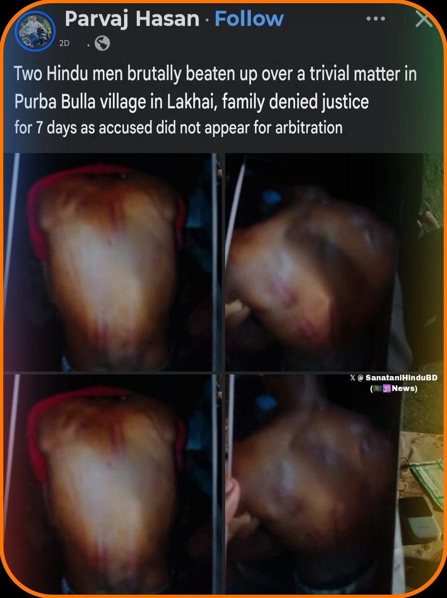 SanataniHinduBD's tweet photo. Bangladesh 🇧🇩 : 2 Hindu man were brutally tortured by a mob . 
Location 📍 Sylhet,Lakhai,East bulla village. https://t.co/xYIe1NPqv1