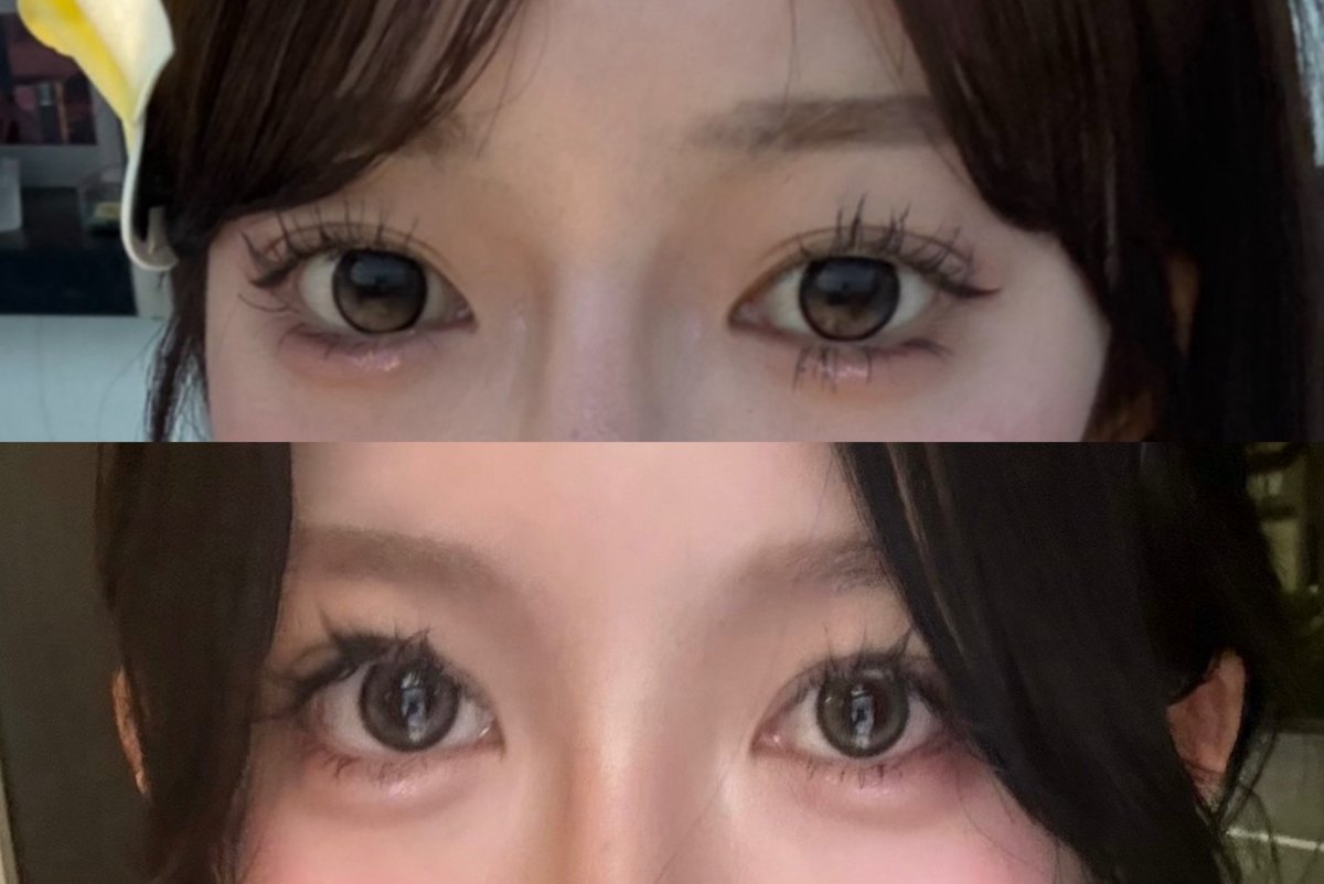 一年の目元の変化✨凹凸がなくて貼り付けたみたいだった眉毛が、眉骨形成で立体感が出て鼻筋の影と馴染んだのが嬉しすぎる😭二重は自然癒着で、裏ハムラもしてます！他に変えたことはマツパからマツエクにしました💄 https://t.co/JiiDlrYZEd