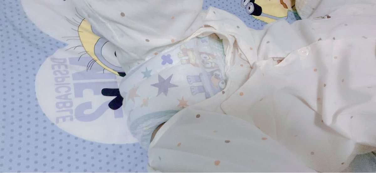 xiaoxii929's tweet photo. 到下午啦 #abdl https://t.co/dJZa3g0jBp