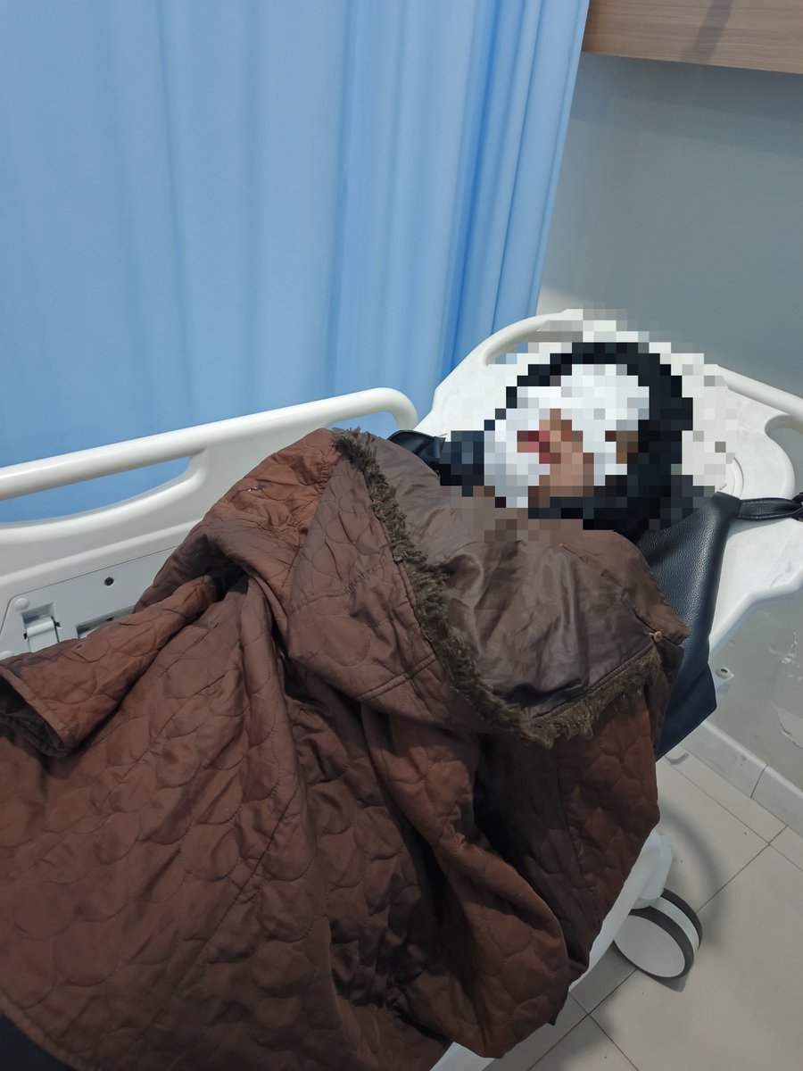 Hira_Keiji's tweet photo. mohon bantuan do'a nya ya temen"
mama ku kena minyak panas dari tangan sampai sebagian muka:"

Semoga baik" aja dan bisa recover seperti semula:") https://t.co/a1VRvru8Iz