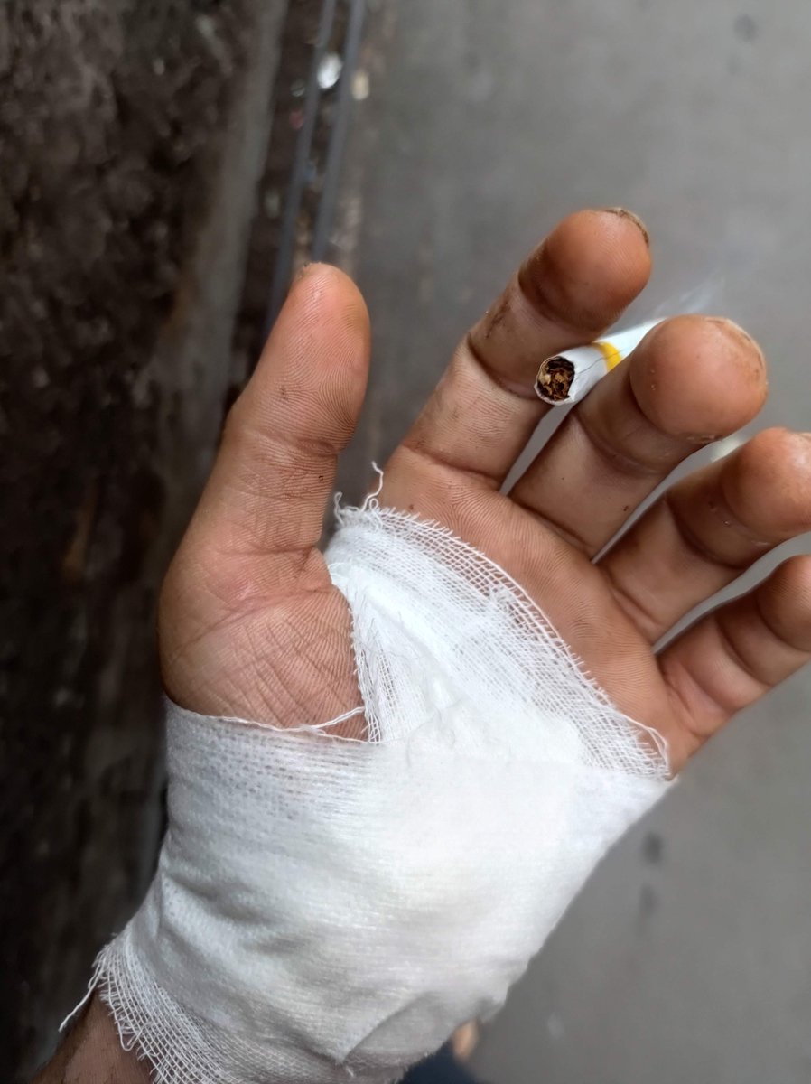 sukamimii's tweet photo. celaka ditempat kerja sampe dijait gaada kompensasi ganti rugi atau tanggung jawab lain eh karena izin bberapa hari tiba² dikeluarin anjg anjgg https://t.co/rbQfEODAPE