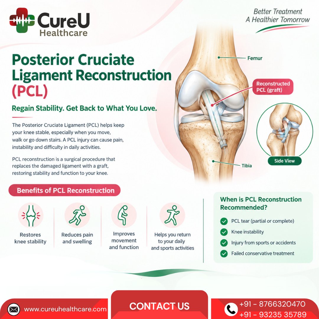 cureU_official's tweet photo. ๐๐๐ ๐๐๐๐จ๐ง๐ฌ๐ญ๐ซ๐ฎ๐๐ญ๐ข๐จ๐ง
A PCL injury can lead to knee pain and instability. PCL reconstruction helps replace the damaged ligament with a graft to support knee stability and function.
#PCL #PCLReconstruction #KneeSurgery #Orthopedics #MedicalTourismIndia https://t.co/PuGEYMm2FX