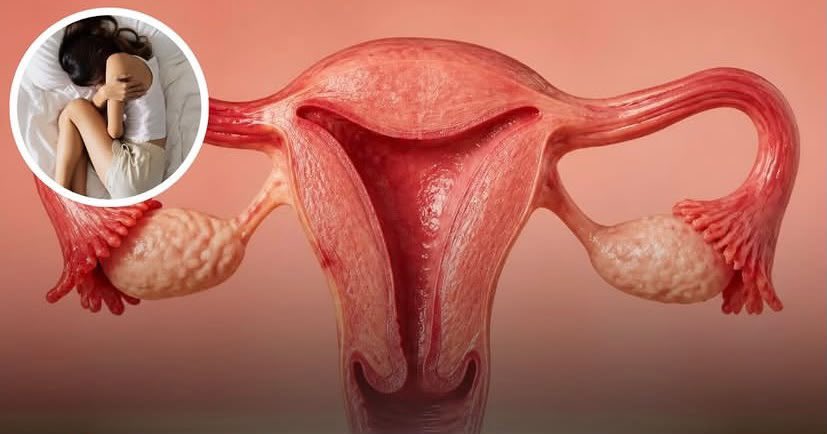 Theveripost's tweet photo. ENDOMETRIOSIS HAS NOW BEEN FOUND IN THE LUNGS, BRAIN, HEART AND OTHER ORGANS IN THE FEMALE BODY-ENDO IS FAR MORE THAN JUST A "BAD PERIOD" DISEASE; IT IS COMPLEX, SYSTEMIC WARFARE WAGED AGAINST THE ENTIRE BODY. https://t.co/XoFbDtiUg8