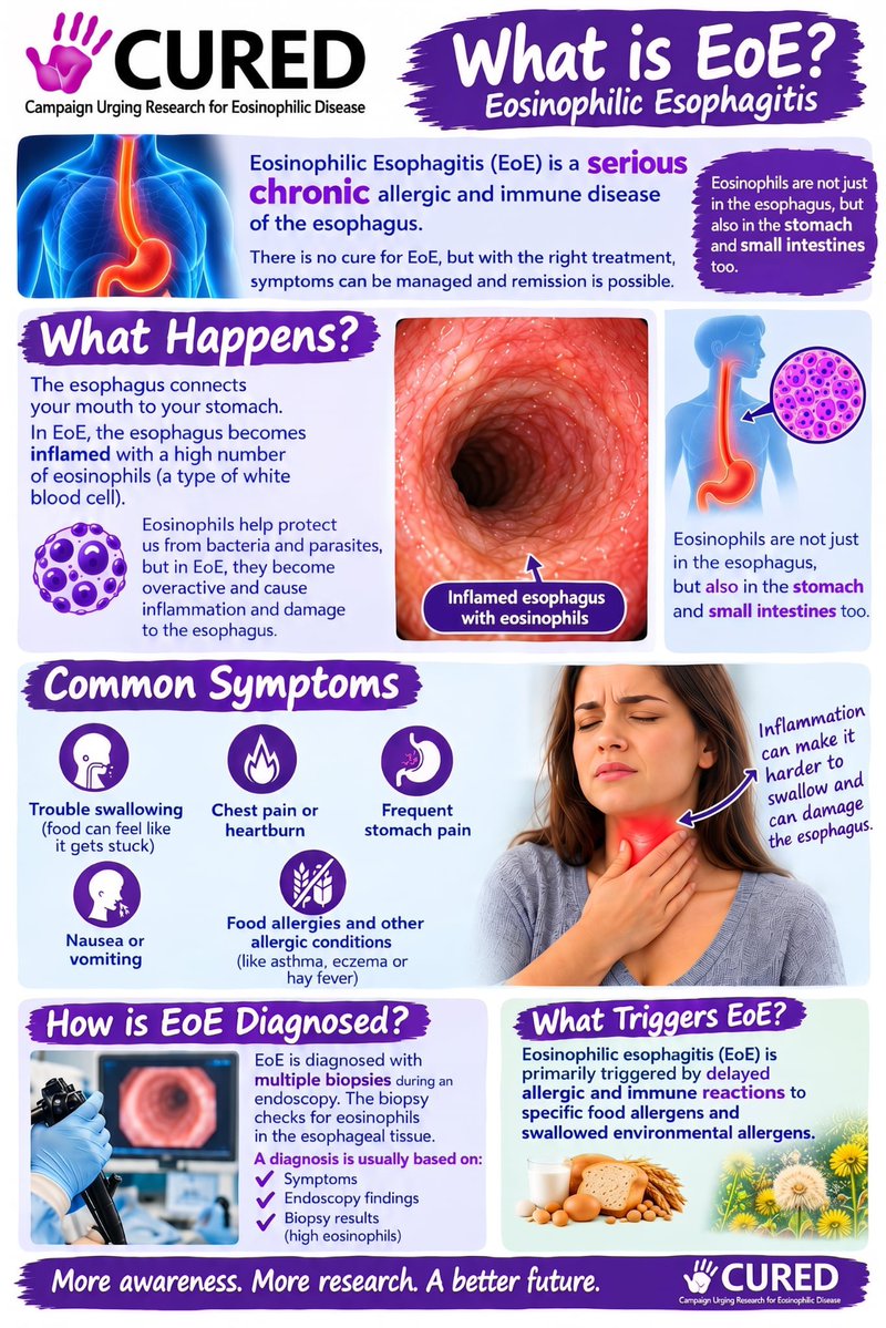 curedfoundation's tweet photo. It’s more than trouble swallowing. It’s EoE.
Eosinophilic Esophagitis affects children and adults every day and too many people still don’t know it exists.
Help us spread awareness. Share this post. #educate #share #spreadawareness https://t.co/A5LWJIof5H